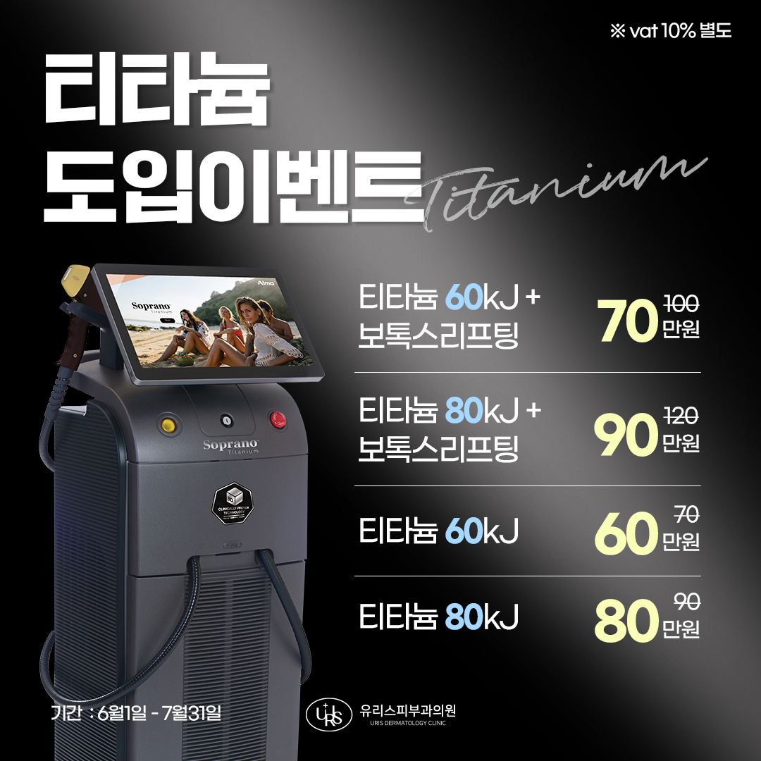 티타늄 도입이벤트